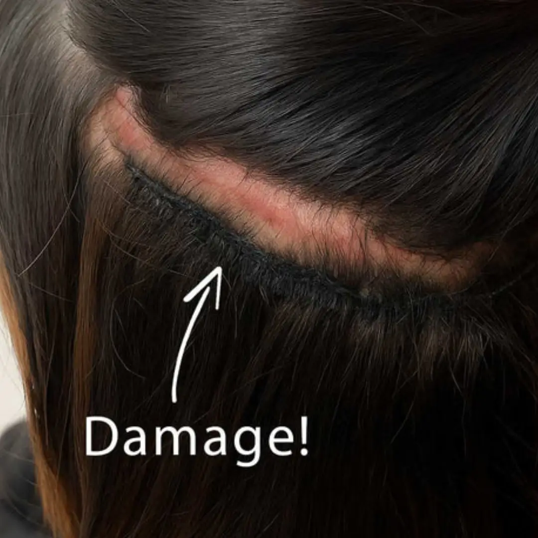 do hair extensions damage your hair