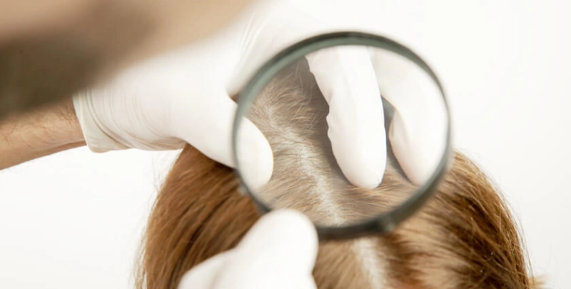 How to Apply Fusion Extensions Like a Pro? 2 hair assessment