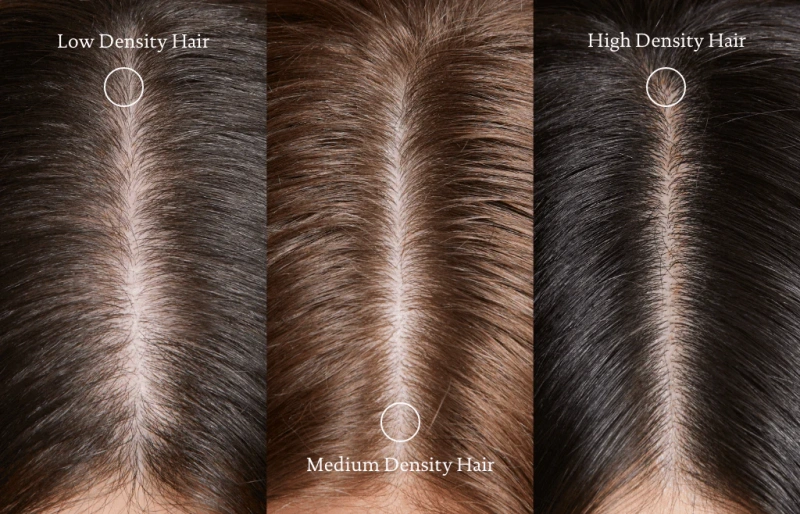 hair density and thickness