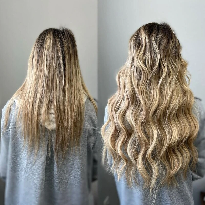 invisible bead extensions before and after​